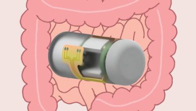 This ingestible inviting capsule can wirelessly video show gut well being in right time